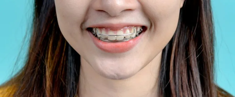 girl wearing a retainer