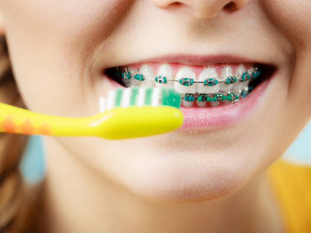 A child with green braces smiles as they prepare to brush their teeth with a yellow toothbrush.
